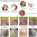 Toenail Tool 6 in 1 Ingrown Toe Nail Fixer Pedicure Toenail Recover Nail Foot Care Kit Ingrown Toenail Corrector for Men Women(24pcs) - Buy Online on SooperMarket.com