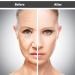 MFUOE 3 Pieces Face Wrinkle Patches Set Forehead Patch Eye Patch Silicone Patch Wrinkle Removal Products Eliminate Wrinkles Fine Lines Skin Care Tools - Buy Online on SooperMarket.com