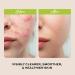 The Natural and Organic Family Clarifying Face Wash with Salicylic Acid - Facial Cleanser for Oily Normal and Combination Skin - Exfoliating Pore Minimizing Formula for Teens and Kids Face Wash Apple - Buy Online on SooperMarket.com