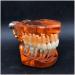 Transparent Dental Model for Adult Dentists | Realistic Teeth & Gums for Teaching & Demonstration - International Shipping - Buy Online on SooperMarket.com