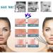 4PCS Blackhead Remover Tool Set for Acne, Comedone, Pimples, Spot, and Zit Extraction - Buy Online on SooperMarket.com