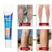 Varicose Veins Cream | Eliminate Spider Veins & Soothing Treatment - International Shipping - Buy Online on SooperMarket.com