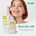 Dermosan CH Anti-Acne Lotion - Chamomile & Hamamelis Natural Clear Skin Formula - Reduce Sebum Acne and Pimple 120ML - Buy Online on SooperMarket.com
