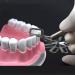 Maskis Interproximal Tooth Enamel Reduction Kit | Orthodontic Stripping for Interproximal Melting | International Shipping Available - Buy Online on SooperMarket.com