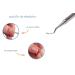 Faude Corner Lifter - Professional Stainless Steel Foot Care Tool for Ingrown Toenails & Nail Cleaning | 17cm Spoon Lifter - Buy Online on SooperMarket.com