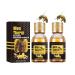 Mentherm Bee Venom Gynecomenia Heating Oil Mentherm Bee Venom Gel Bee Venom Oil Men Therm Bee Venom Oil Bee Venom Gel Can Help Strengthen The Chest Muscle (2Stk)