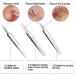 Blackhead Remover Tool Kit - FEITA Acne Pimple Tweezers Comedone Extractor Blemish Removal Tool Set for Facial Whitehead Popping Zit Removing - Buy Online on SooperMarket.com