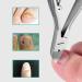 jklashfi 3X Professional Feet Toe Nail Clippers Trimmer Paronychia Nippers Podiatry Stainless Tools - Buy Online on SooperMarket.com
