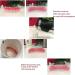 Temporary Dental Veneers for Natural Teeth Restoration - Upper & Lower Jaw, Natural Shade - Buy Online on SooperMarket.com