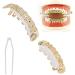 Denture Sets Dental Decorative Brackets Hip Hop Dental Supports Hip Hop Dental Decorations(Gold) - Buy Online on SooperMarket.com