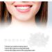 50pcs Temporary Crown Harz Fake Teeth Veneers for Men Women & Teens | Multi-Application Dental Repair & Oral Care - Buy Online on SooperMarket.com