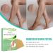 Varicose Veins Patch - Effective Treatment for Spider Veins | 12 Pcs | Fast International Shipping - Buy Online on SooperMarket.com