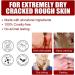 BStCar Foot Mask Socks | 5 Pairs for Men & Women | Moisturizing Foot Care Exfoliates Dead Skin & Calluses - Buy Online on SooperMarket.com