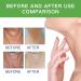Neck Firming Cream Tighten and Lift Neck Cream Neck Line Remover Neck Tightening and Firming Vitamin C Vitamin E Moisturizing Anti Aging Reduce Neck Fine Lines Improve Roughness - Buy Online on SooperMarket.com