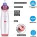 Rechargeable Blackhead Vacuum Remover with 5 Probes - Electric Facial Acne Suction Cleanser - Buy Online on SooperMarket.com