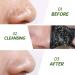 JVR Nose Strips for Blackhead Removal | Deep Cleansing Pore Strips with Charcoal & Witch Hazel | 10 Count for Oily Skin - Buy Online on SooperMarket.com