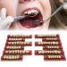 Buy Complete Resin Dentures | High-Quality Artificial Teeth & Dental Supplies for International Shipping - Buy Online on SooperMarket.com