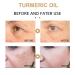 2022 Turmeric Dark Spot Corrector Serum for Face - Natural Skin Care Moisturizing Serum (2PCS-60ml) - Buy Online on SooperMarket.com