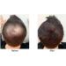Caboki Hair Loss Concealer Hair Building Fiber 25g (Black) - Buy Online on SooperMarket.com