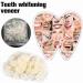 ChezMax Temporary Tooth Repair Kit - Fix Missing & Broken Teeth - Natural Solution - Buy Online on SooperMarket.com