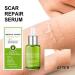 BEALIFE Belly Hip Chest Stretch Mark Removal Ladies Postpartum Body Burn Scars Repair Essence Anti-aging 30ml - Buy Online on SooperMarket.com