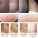 RtopR Mango Stretch Marks & Scar Cream - Pregnancy Safe Moisturizer - 80g (Pack of 2) - Buy Online on SooperMarket.com
