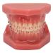 Orthodontic Demonstration Model for Dental Research | Metal Wires & Ceramic Brackets | Teaching Aids for Adults - Buy Internationally - Buy Online on SooperMarket.com