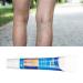 Varicose Veins Cream | Eliminate Spider Veins & Soothing Treatment - International Shipping - Buy Online on SooperMarket.com