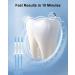 MySmile Teeth Whitening Kit with LED Light - Fast Non-Sensitive Whitener with 3 Carbamide Peroxide Gels - Remove Stains from Coffee, Smoking, Wine & Food - 10 Min Treatment - Buy Online on SooperMarket.com