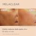 ISDIN Melaclear Dark Spot Correcting Serum - Vitamin C & Phytic Acid for Sensitive Skin - Buy Online on SooperMarket.com