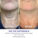 goPure Neck Firming Cream Anti-Aging Neck Cream for Tightening Wrinkles & Even Skin Tone | Pro-Active Firming Complex - 1.7 oz - Buy Online on SooperMarket.com
