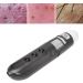 Skin Diagnosis Hair Analyzer 800x Hair Scalp Detector With 2MP USB HD Electronic Digital Microscope - Buy Online on SooperMarket.com