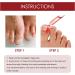 Toenailplus Anti Paronychia Relief Oil - 10ml 2pcs - Nail Helper for Ingrowth Toenail Correction & Paronychia Treatment - Buy Online on SooperMarket.com
