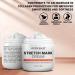 Mystre Beaut Stretch Mark Cream - Reduces Stretch Marks, Moisturizes Skin with Cocoa Butter & Shea Butter - Vitamins A & E Skincare for Mamas - All Skin Types - 4 oz - Buy Online on SooperMarket.com