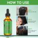 Rosemary Hair Growth Oil & Serum - Dry Scalp Treatment for Women | Hair Thickening & Essential Oil (2OZ) - Boost Hair Growth & Combat Hair Loss - Buy Online on SooperMarket.com