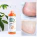 Foot Peeling Spray with Orange Oil Exfoliate Dead Skin & Calluses Fast | Hydrating & Nourishing Formula - Buy Online on SooperMarket.com