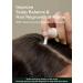 AROMATICA Rosemary Scalp Strengthening Duo Set - Nourish & Relieve Itchy Scalp with Food-Grade Rosemary Oil - Sulfate Silicone & Paraben Free - International Shipping Available - Buy Online on SooperMarket.com