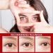 Speedy Milia Remover Milia Remover Milia Remover Under Eyes Milia Spot Serum for Face Helps Dissolve and Reduce Milia Dark Spot Remover to Reduce Milia Dark Circles Under Eye for Women & Men - Buy Online on SooperMarket.com
