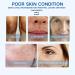 Trendyfave Hyaluronic Acid Serum Serums Skincare Moisturiser Face Women For Anti Aging Firming And Plumping Of Skin Fine Lines Deep Wrinkle Filler Brightening Serum Hydrating Serum With Glycerin - Buy Online on SooperMarket.com