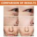 Vitamin C & Vitamin E Serum Facial Set Morning C and Night E Skincare Gift Set Anti-Wrinkle Tighten Skincare Set with Vitamin C & Collagen Serum (Day Use) Retinol & Vitamin E Serum(Night Use) - Buy Online on SooperMarket.com
