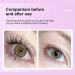 Teksome Eyelash Holder Pads 5 Pairs Lower Pads for Lash Lifting Reusable Under Eye Lash Lift Pad Reusable Lash Lift Supplies Skin-Friendly - Buy Online on SooperMarket.com