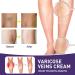 Varicose Vein & Spider Vein Cream | Capillary Health Treatment | Improve Circulation 0.7oz - Buy Online on SooperMarket.com
