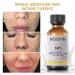 50% Citric Acid Peeling Serum for Face | Skin Peel Solution for Dark Spots & Acne | Exfoliating Chemical Peel 30ml - Buy Online on SooperMarket.com