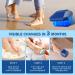 Nail Fungus Cleaning Device for Multiple fingers 905nm Infrared Light + 470nm Blue Light Highly Effective Treatment for Home Use Treat and effectively prevent (Navy) - Buy Online on SooperMarket.com