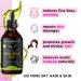 Moringa Oil - USDA Organic 100% Pure & Cold Pressed | Natural Moisturizer for Skin Face Hair | Gluten Free Non-GMO & Vegan (2oz - Buy Online on SooperMarket.com