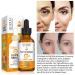 20% Vitamin C Serum for Face with Hyaluronic Acid - Anti-Aging Facial Serum for Men & Women Fades Dark Spots Boosts Collagen Hydrates & Plumps Skin - 1 Fl Oz - Buy Online on SooperMarket.com