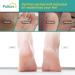 Puikos Moisturizing Gel Heel Sleeves for Cracked Feet - Overnight Treatment for Dry Heels - Men and Women's Heel Repair Socks - Buy Online on SooperMarket.com