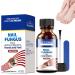 Fungal Nail Treatment For Toenails - Extra Strong Nail Fungus Treatment for Toenail - Toe Nail Fungal Treatment - Anti-Fungal Nail Repair Treatment with Nail File and Nail Brush
