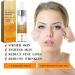 New Zealand Bee Venom and Manuka Honey Serum Manuka Honey Serum for Face Honey Facial Serum Honey Anti-Aging Serum Anti-Aging Serum Honey Face Serum (1Pcs) - Buy Online on SooperMarket.com