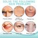 Face Wrinkle Patches Face Lifting Patches Face Lift Tape Anti Wrinkle Patches Reusable Silicone Wrinkle Pads Face Tape For Wrinkles Silicone Face Patches for Skin Lines Prevention - Buy Online on SooperMarket.com